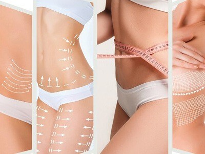 Post Bariatric Surgery